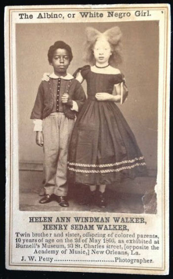 Selling black and white children?